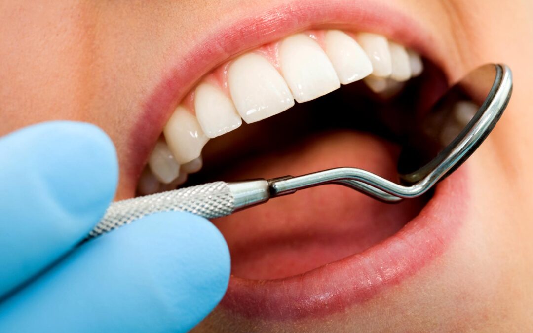 Zahnfleischbehandlung